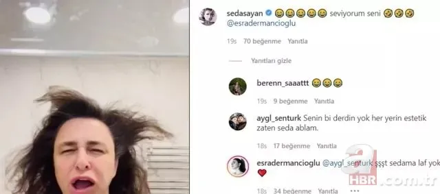 Esra Dermancıoğlu’nun estetik göndermesine Seda Sayan kayıtsız kalamadı! Cevabı olay oldu