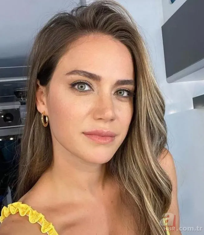 Ceyda Ateş’ten estetik itirafı! Set kazası kabusu oldu 3 kez ameliyat masasına yattı 2