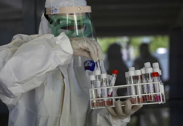 Türkiye 15 ülke için Covid-19 önlemi kapsamında uygulanan PCR testi zorunluluğunu kaldırdı - 3