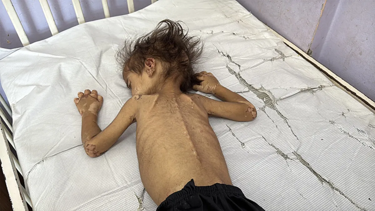 İsrail 24 saatte 5 Filistinliyi daha açlıkla katletti