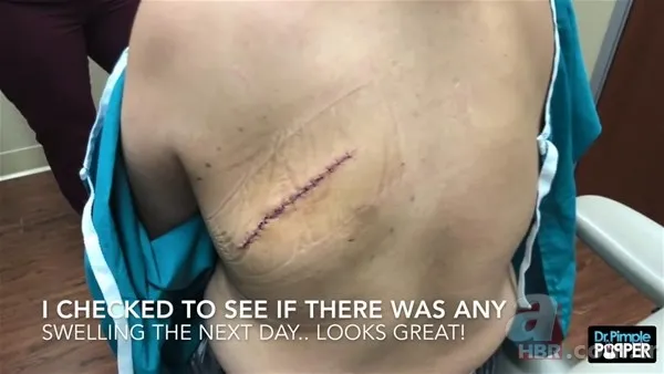 30 yıl boyunca baş ağrısıyla yaşadı! Nedeni şoke etti... 141