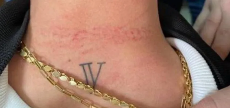 Eşinin canını acıttığı iddiasıyla doktora saldırdı! Tutuklandı