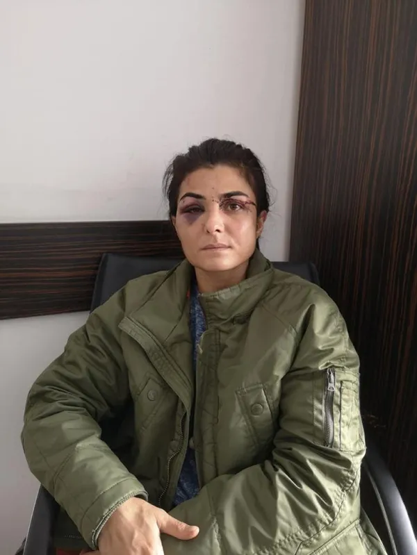 Son dakika: Kendisine işkence yapan eşini öldürmüştü! Melek İpek için istenen ceza belli oldu - 6