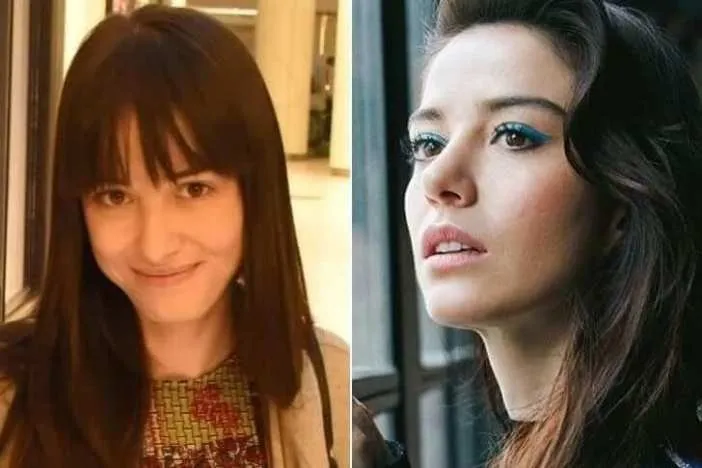 Ozge Gurel In Estetiksiz Hali Soke Etti Degisimi Pes Dedirtti