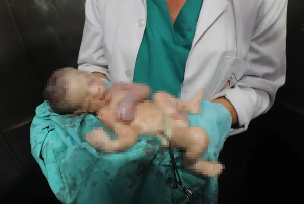 1698824093333.jpg Gazze'de insanlık suçu! Katili İsrail bir yaşını doldurmamış 133 bebeği öldürdü! Filistinli kadınların çaresizliği: Fener ışığında anestezisiz sezaryan doğum - 3
