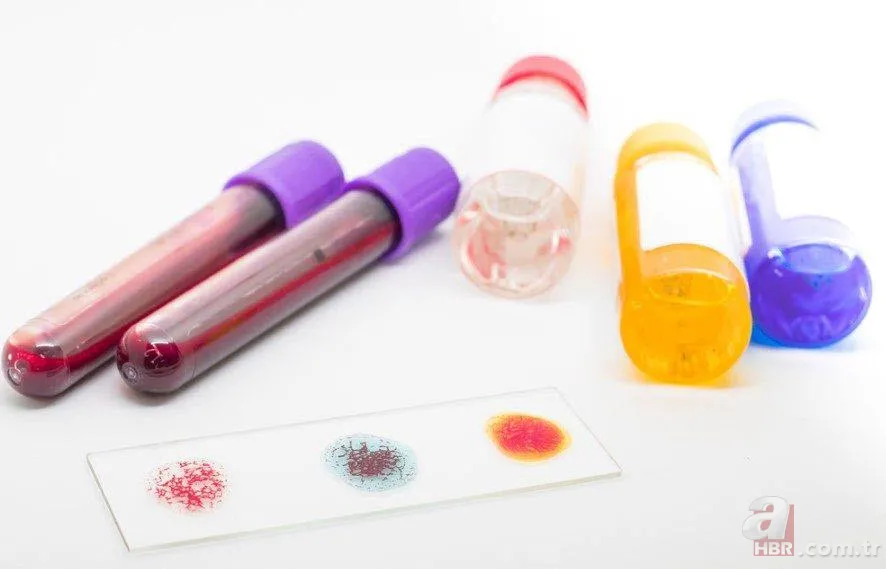 Hangi kan grubu nasıl beslenmeli? İşte kan grubunuza göre tüketmeniz gereken besinler... 10