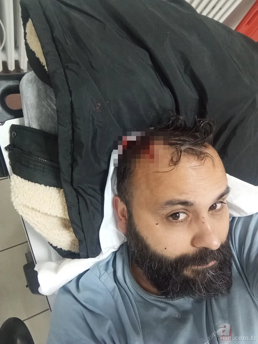 Sosyal medya fenomenine kanlı pusu! Hırsızlık süsüyle tuzağa çektiler: Öleceğini zannedip şehadet getirdi 7