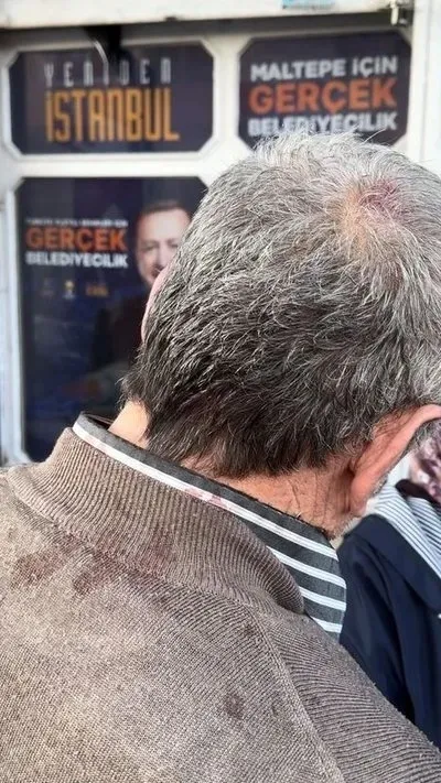 chpli-gruptan-alcak-saldiri-ramazan-amcayi-yere-yatirip-tekmelediler-ak-partiden-sert-tepki-1711228190884.jpeg CHP'li gruptan alçak saldırı! Ramazan amcayı yere yatırıp tekmelediler | AK Parti'den sert tepki - 1