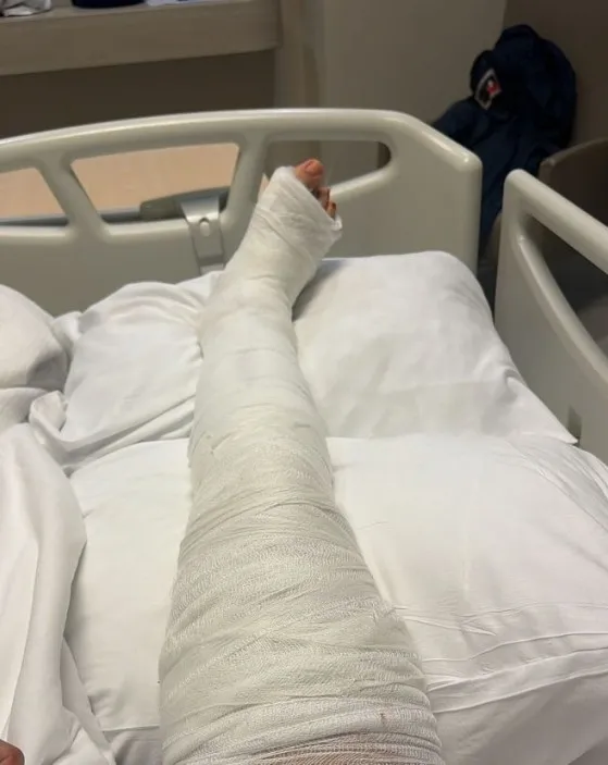 yasemin-yurukun-ayagi-kirildi-hastanedeki-goruntusu-ortaya-cikti-1773319996171.jpg Kaynak: Sosyal medya