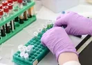 SMA testi açıklaması! Tarih verildi