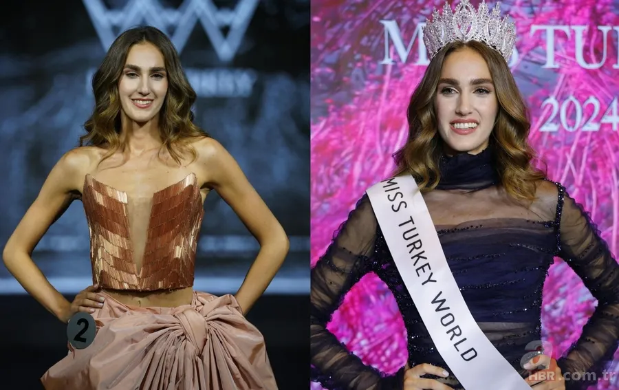 Büyük değişim! Miss Turkey 1. İdil Bilgen'in son hali şaşırttı 1