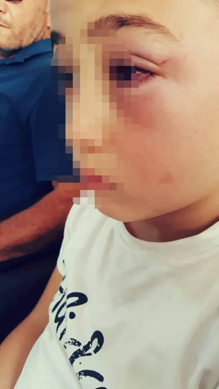 Oğluyla tartışan 9 yaşındaki çocuğu darp etti - 2