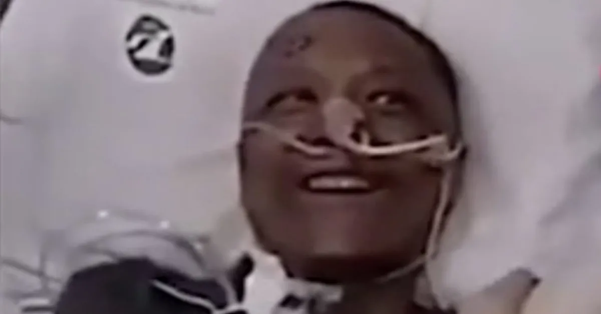 Son dakika: Koronavirüs sonrası ten rengi değişen Çinli doktorun son hali hayrete düşürdü