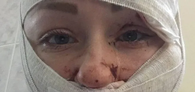 Son dakika: Falçatayla Anna Butim'in yüzünü kesmişti! Cani koca Mesut Öztürkmen'in ifadesi ortaya çıktı