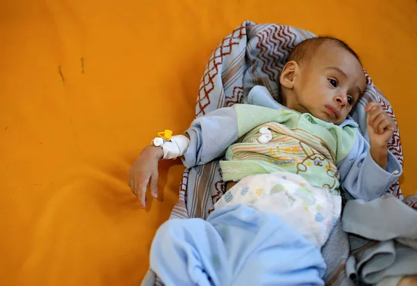 "Yemen, dünyanın en büyük insani krizlerinden birini yaşıyor" - 1