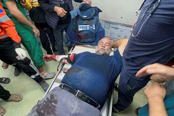 1702672509071.jpg Katil İsrail bir gazeteciyi daha şehit etti! Daha önce eşi, oğlu ve kızını kaybeden Al Jazeera muhabiri Wael Dahdouh yaralandı - 2