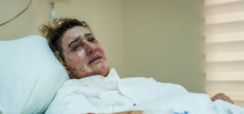 Sevgilisi kızgın yağ ile yakmıştı! 14 yıl ceza verilince "Bırakın onu" diye yalvardı