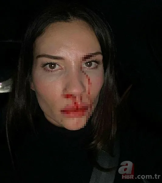 Özer Hurmacı ve Mihriban Hurmacı'nın darp davasında flaş gelişme 3