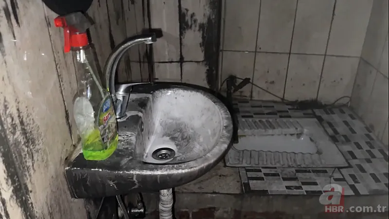 Kuaförde korkunç olay! 14 yaşındaki çocuğun tüm vücudu yandı 3