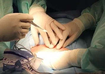 Antalya'da organ bağışı bayram öncesi 3 hastaya umut oldu