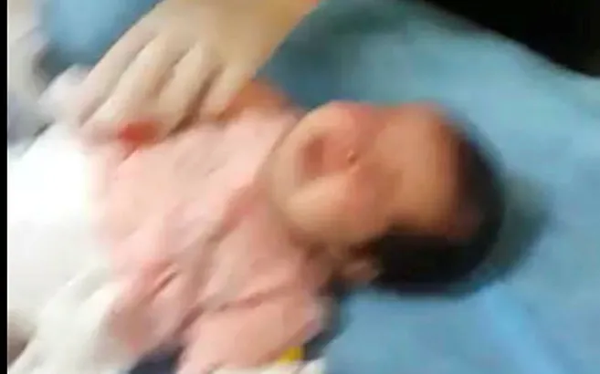 Hemşire bebeğin parmağını makasla kesmişti!