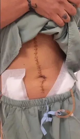 abdde-olu-bulunmustu-fenomen-yagmur-taktasin-mezari-acildi-yeniden-otopsi-yapilacak-1714995525841.jpg ABD'de ölü bulunmuştu! Fenomen Yağmur Taktaş'ın mezarı açıldı! Yeniden otopsi yapılacak - 5