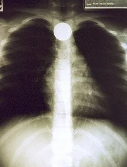 Hamile atın röntgeni çekildi! Şaşırtan röntgen filmleri...