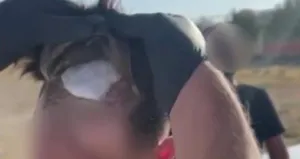 Protez saçtan çıkan şoke etti