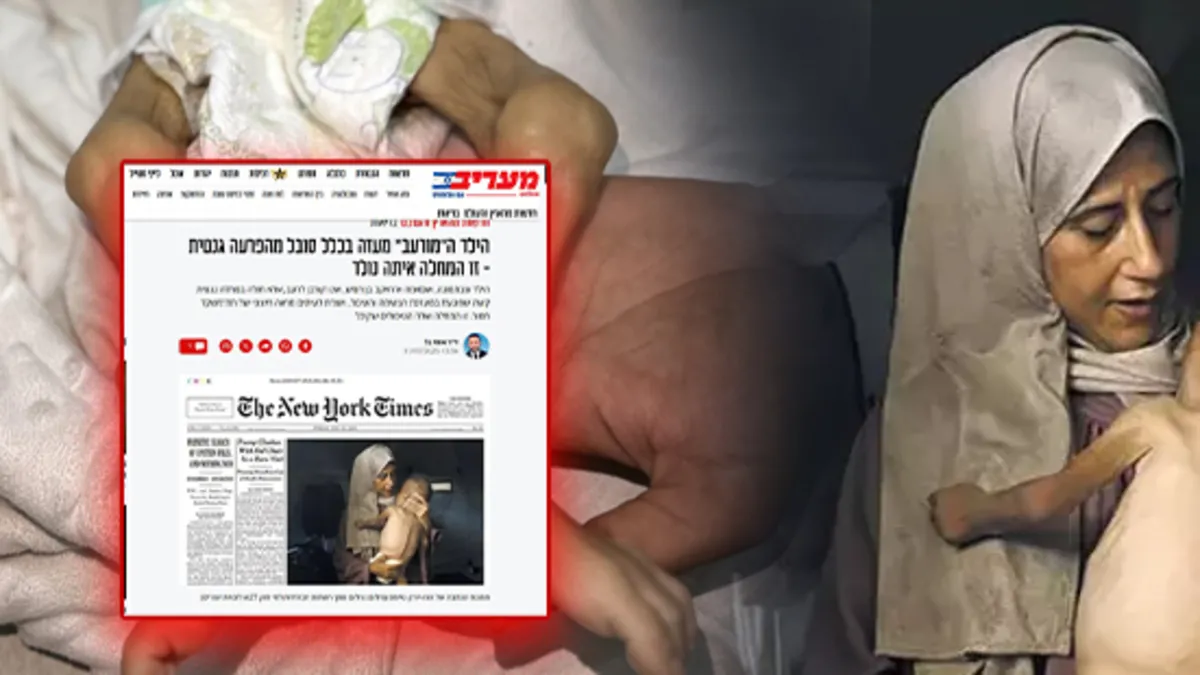 İsrail'den NYT'nin manşete taşıdığı acı fotoğrafa "pişkin" sözler! Açlık silahına "genetik hastalık" kılıfı
