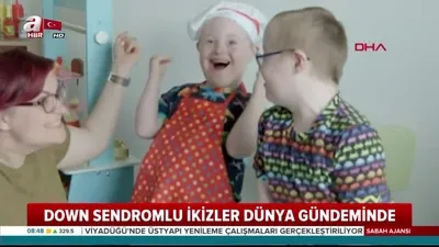 Down sendromlu ikizler dünya gündeminde!