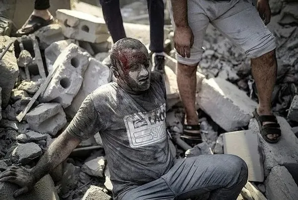 Katliamın ortasında baba tesellisi! Bombardıman korkusuyla ağlayan çocuklarına kol kanat gerdi