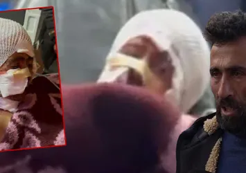Erzurum'da başıboş dehşeti! Yoğun bakımdaki minik Murat'ın babası isyan etti: Bu acıya nasıl dayanacak?