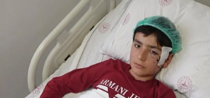 Aksaray’da koyun otlatan küçük çocuk pitbull saldırısına uğradı! "Kardeşlerim olmasaydı beni daha kötü yapacaktı"