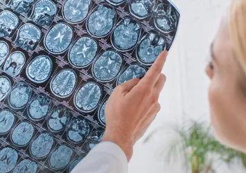 13 haftada 9 beyin ameliyatı geçirdi! Kafatası parçasını midesinde taşıdı