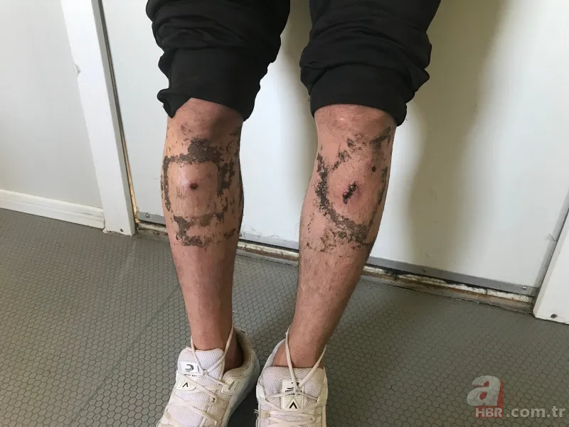 Yunanistan polisinin ‘göçmen zulmü’ devam ediyor 6