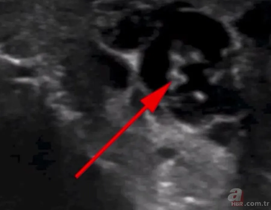 Doktora gitti hayatının şokunu yaşadı 👨⚕️ Sivrisinek ısırığı kabusu oldu 🦟 Dans eden düzinelerce... 8