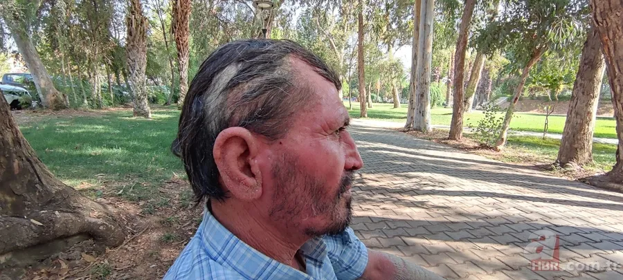 3 senedir gözlerini kapatamıyor! Sağlığına kavuşmak için Türkiye’ye geldi 17