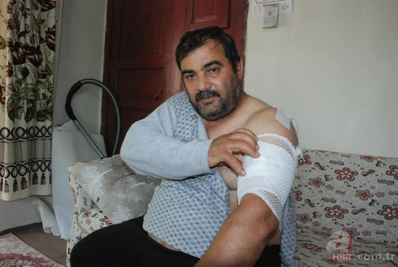 Bartın'da ayı saldırısı! 65 dikiş atıldı: Öldüğümü sanıp bıraktı 6