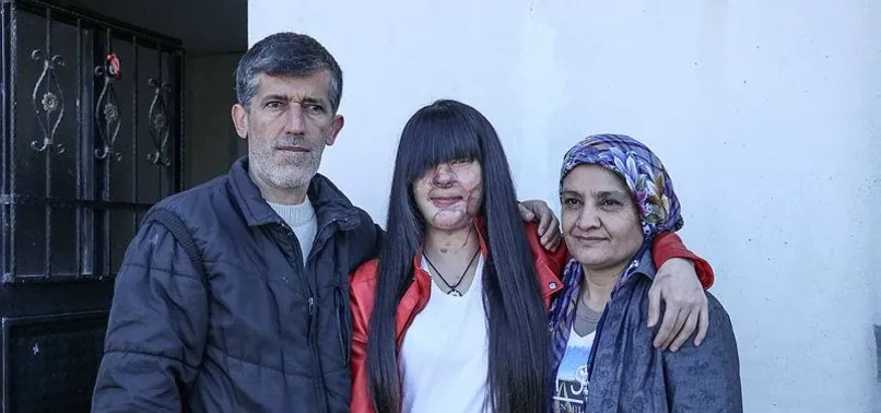 Yüzünü yakan Casim Ozan Çeltik ile evlenen Berfin Özek'e babasından tepki!