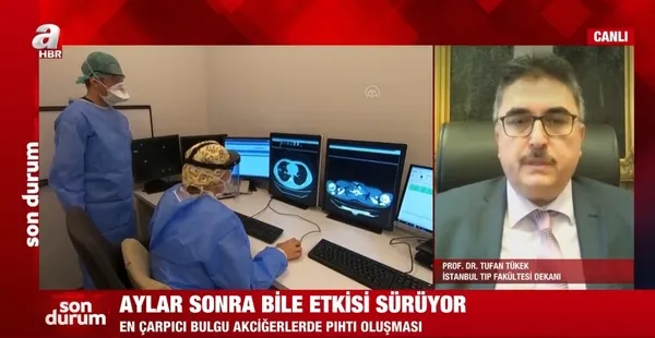 Prof. Dr. Tufan Tükek A Haber canlı yayınında Kovid-19'daki yeni bulguyu açıkladı - 3