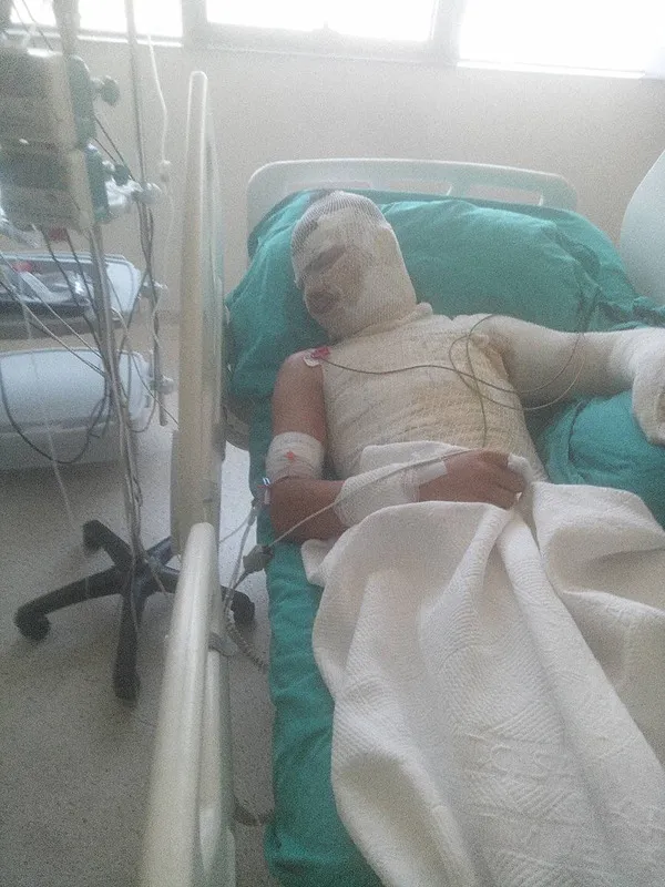 adanada-amca-yegenini-yakmisti-o-anlarin-goruntusu-ortaya-cikti-1750923506618.jpeg Amcası tarafından yakılan Deniz K.'nın tedavisi devam ediyor (İHA)