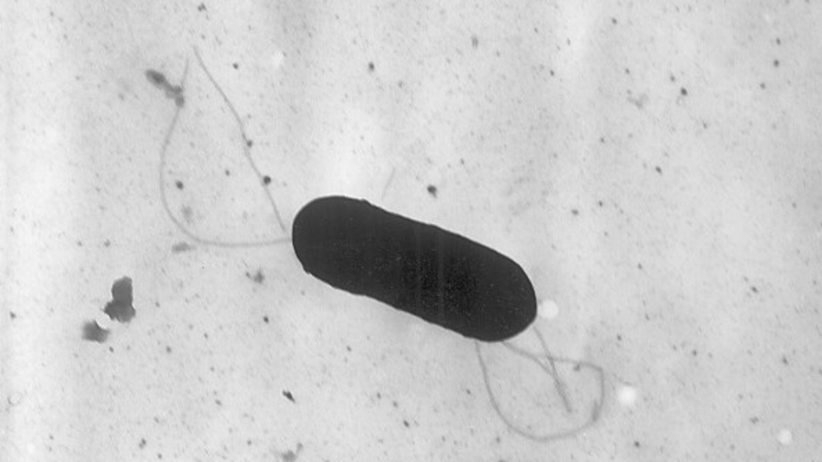 ABD'de listeria bakterisi salgını! 6 ölü 25 hasta