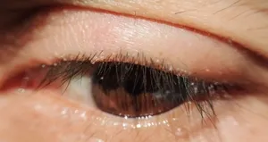 Kirpik dipleriniz böyle görünüyorsa dikkat! Sebebi bakın neymiş...