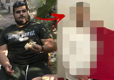 Son halini arkadaşları bile tanıyamadı! "Kısa sürede nasıl kilo veririm?" diye çözüm yolları aradı... 8 ayda 75 kilo verdi