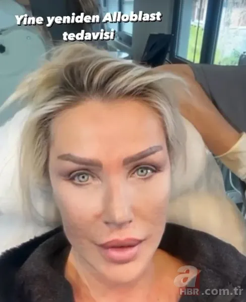 Gençleşmek için bunu da yaptı! Seda Sayan'ın son hali şaşırttı! O işlemi bir kez daha denedi... 6