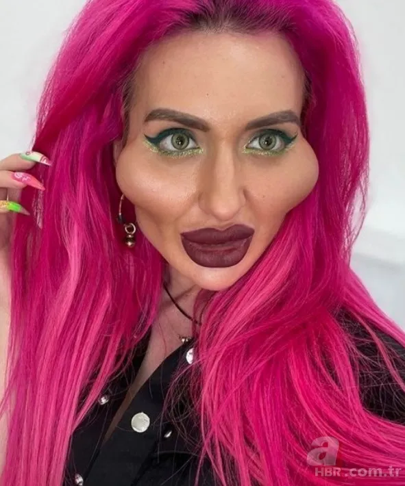 Fatih’te estetik yaptıran Bulgar modelin hayatı kabusa döndü! ‘Örümcek ağı’ operasyonu bakın ne hale getirdi? 20