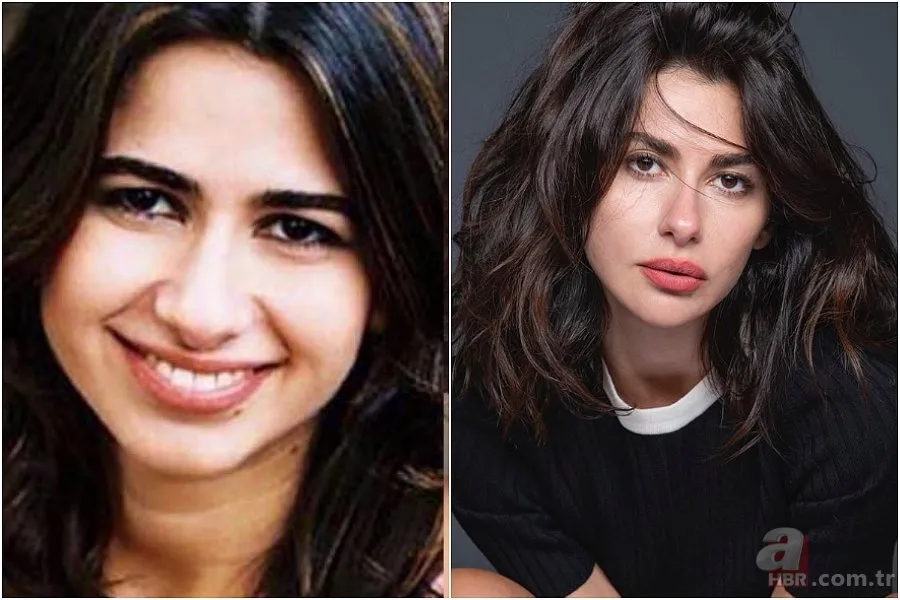 Seda Sayan'ın son hali şaşkına çevirdi! Estetik sonrası... 18