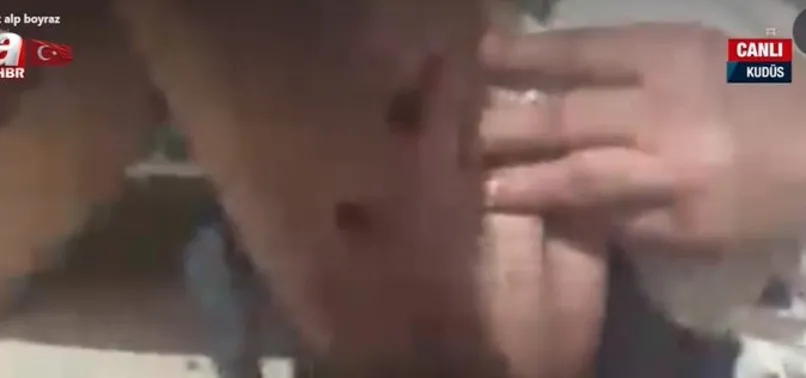 Kudüs'te Türk gazeteci vuruldu! İsrail terör eylemlerine devam ediyor