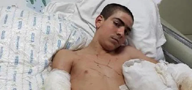 Pitbull saldırısına uğrayan çocuk ağır yaralandı