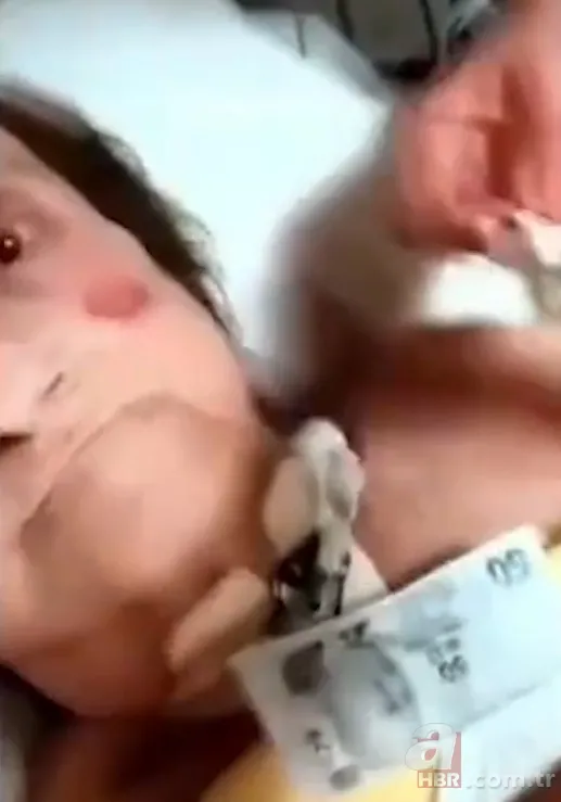 Özel hastanede skandal! Yoğun bakımdaki yaşlı kadına işkence yapıp kayda aldılar 22